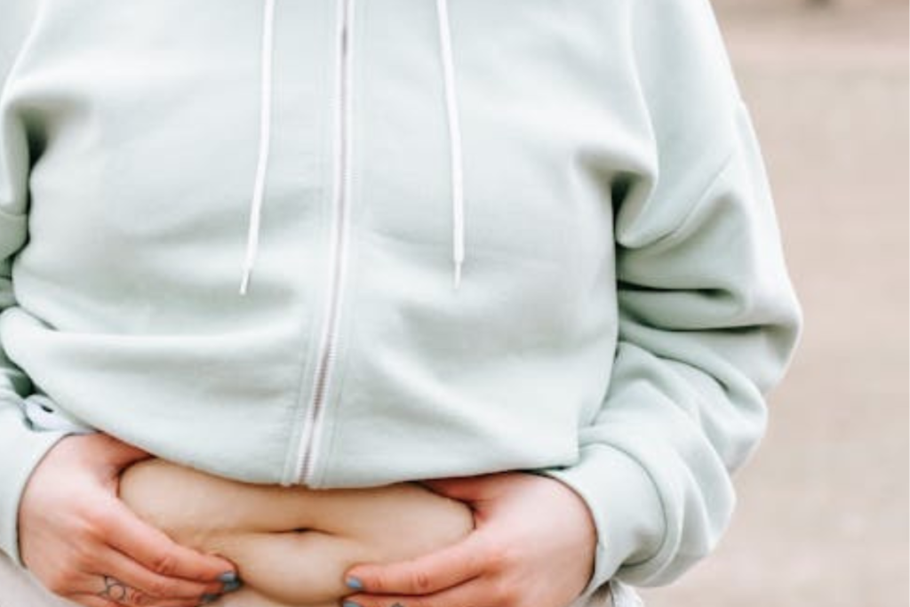 The Miami Model of Weight Loss