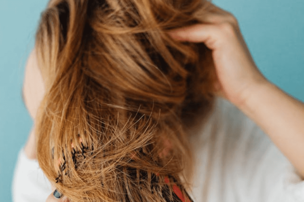 hair loss in females